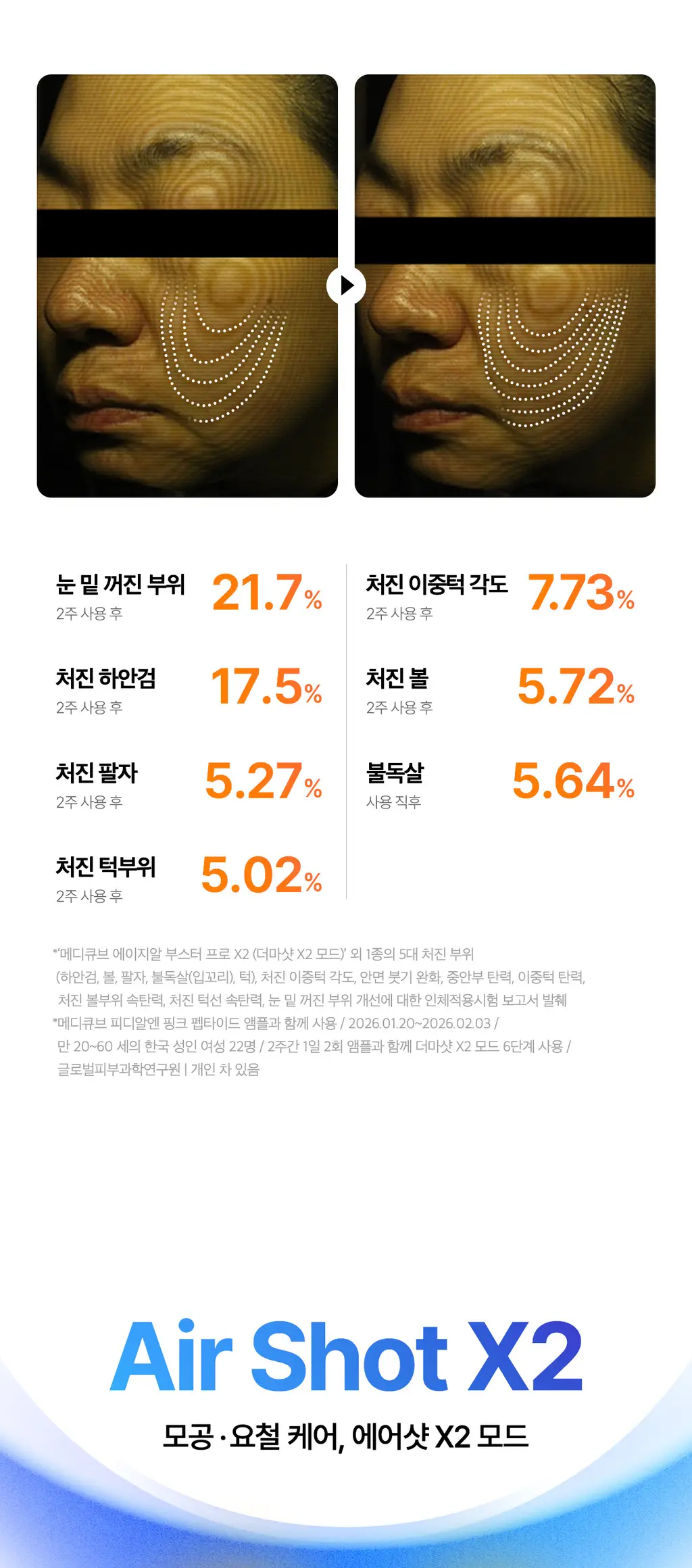 [5월올영픽] [UPGRADE] 메디큐브 에이지알 부스터 프로 X2 (핑크/화이트) 상세페이지 38